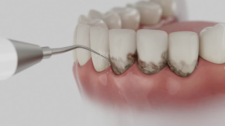 Trusted Teeth Cleaning And Checkup service in West Siloam Springs, OK - Dentist Open Now